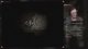 Preshow con Expedition 33 + Fear &amp; Hunger 2: Termina, Blindrun w/Sabaku #11